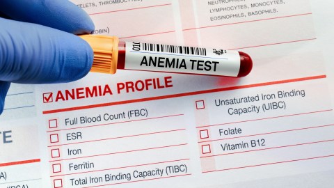 when-anemia-can-be-an-indicator-of-cancer-or-mortality