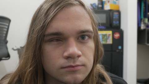 tucker-collins’-family-demands-investigation-after-eye-loss-in-protest-in-los-angeles