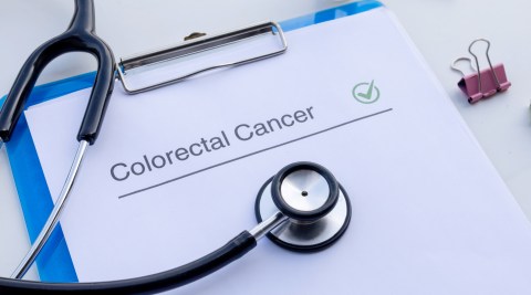 dna-tests-sent-by-mail,-a-new-method-in-the-detection-of-colorectal-cancer