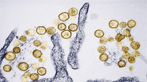 what-is-hantavirus,-the-infection-suspected-of-causing-3-deaths-on-a-cruise-ship-that-set-sail-from-argentina
