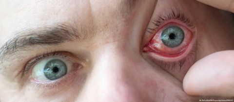 a-researcher-created-a-fictitious-disease-to-test-ai-and-the-result-was-not-what-was-expected