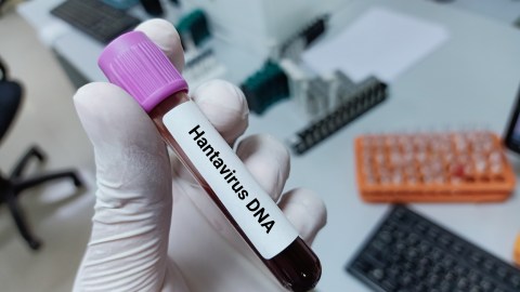 what-are-the-risks-of-hantavirus-in-the-us?-this-is-what-the-cdc-says