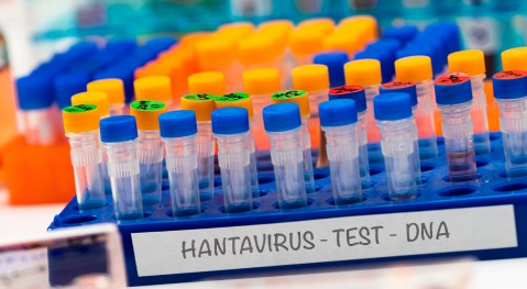 the-hantavirus-is-highly-contagious-at-the-beginning,-warns-the-who.-quarantine-recommended-for-suspected-cases