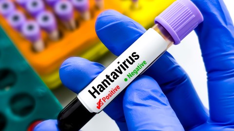 they-confirm-that-a-drug-used-for-another-disease-works-against-hantavirus