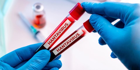 why-hantavirus-is-not-like-covid:-similarities-and-differences
