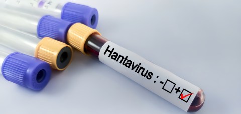 revelations-about-the-andes-strain:-first-genetic-analysis-of-the-cruise-hantavirus-rules-out-that-it-is-due-to-mutations